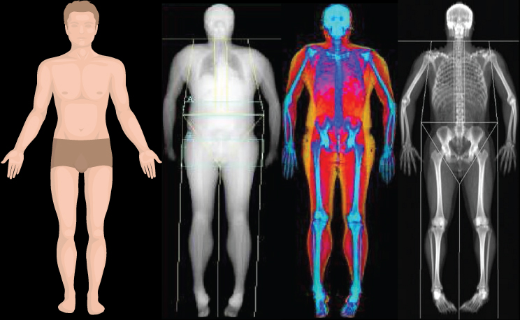Body composition scan, Body scan near me